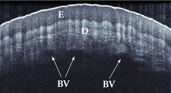 Human Finger OCT Image